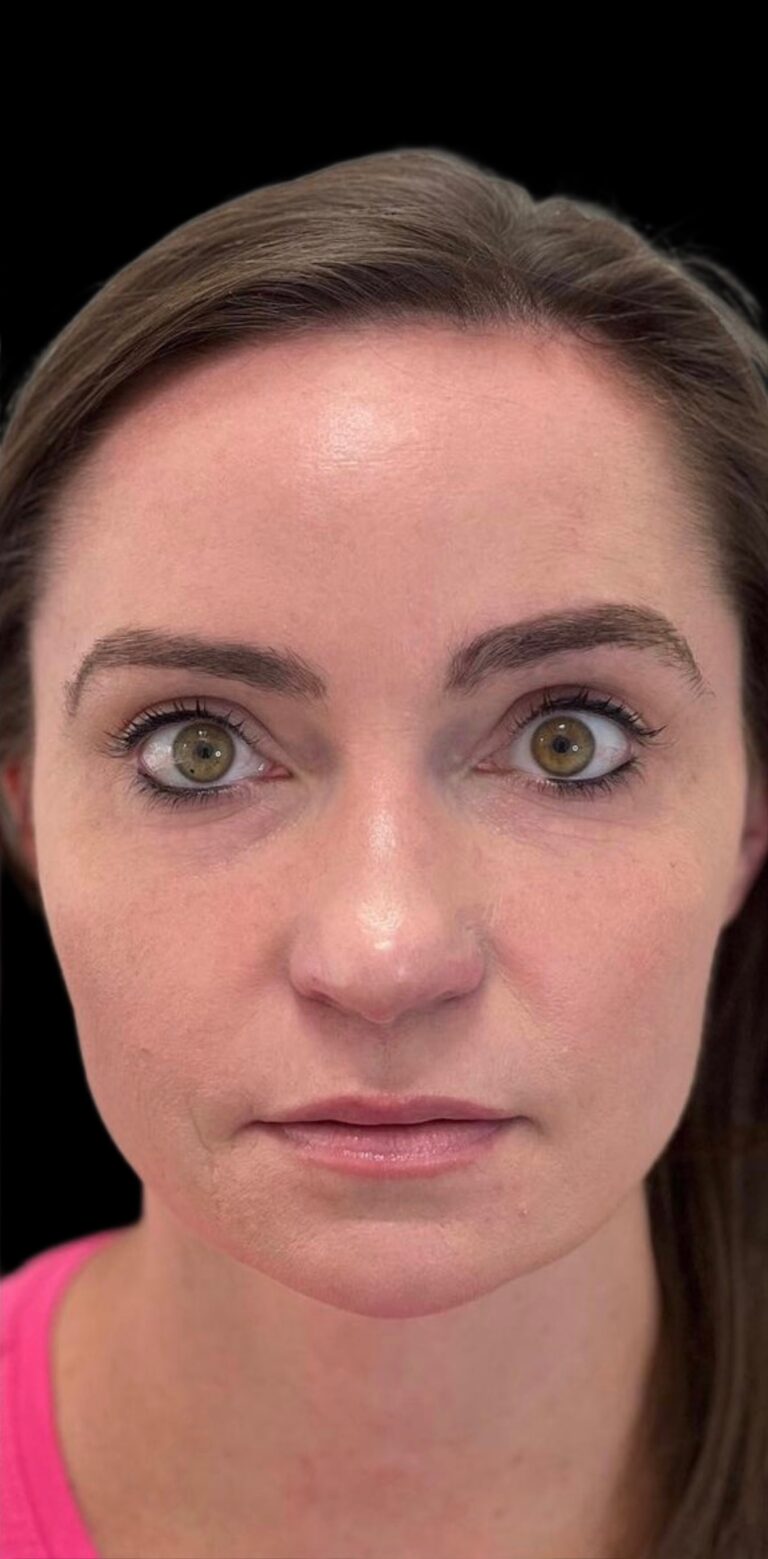 After Image: Neurotoxin - front